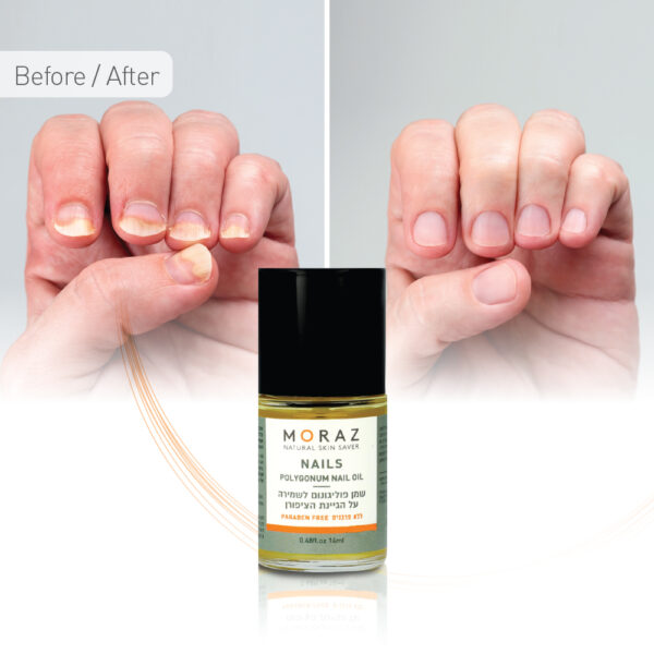 Infographic Nails oil
